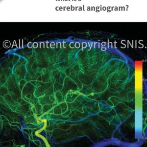 Cerebral Angiography brochures (pack of 100)